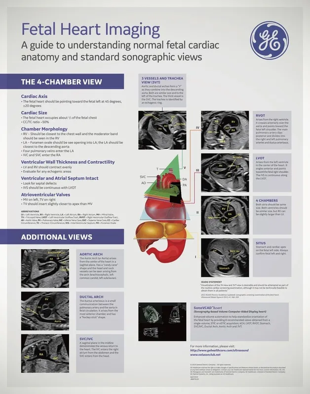  Fetal Heart Imaging Guide 