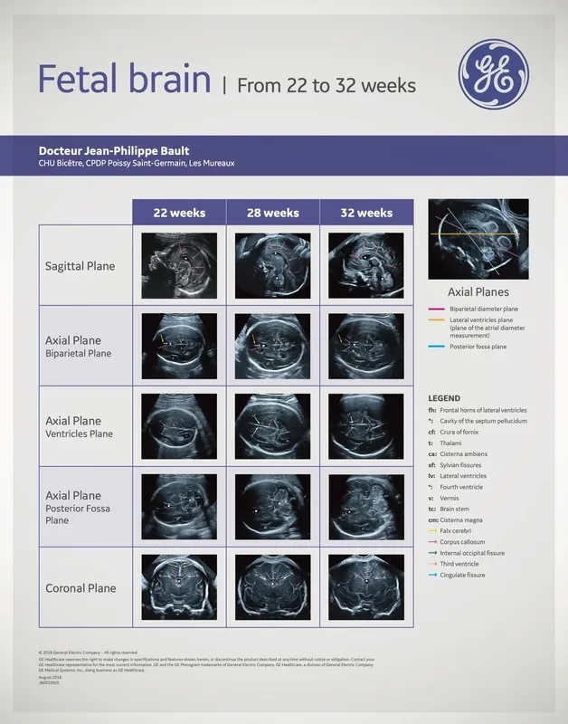  Fetal Brain