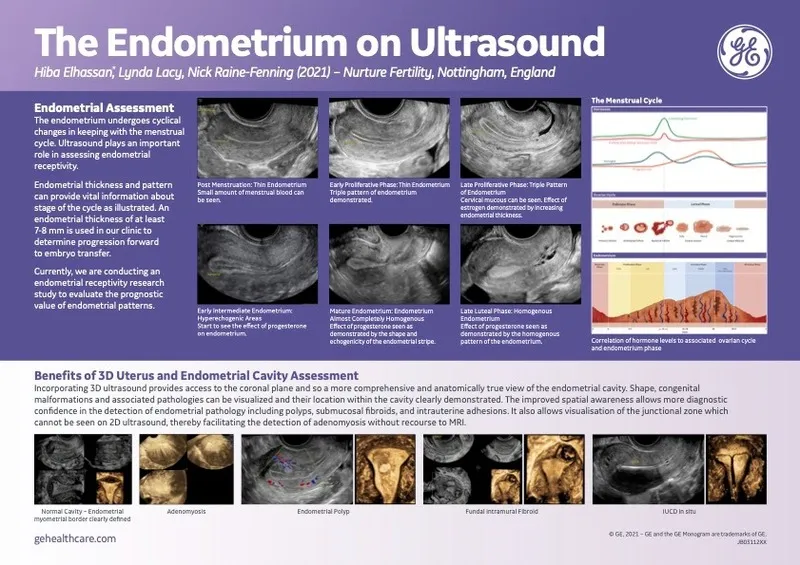  The Endometrium on Ultrasound